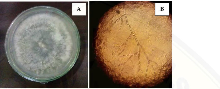 Gambar 4.6 Hasil isolasi jamur penyakit Phytophthora nicotianae. (A) Koloni P.nicotianae pada 