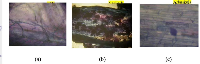 Gambar 2. Struktur FMA di dalam akar, (a) Hifa, (b) Vesikula, (c) Arbuskula.                                                                               
