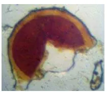 Gambar 17. Acaulospora sp. pada larutan melzer’s reagent  