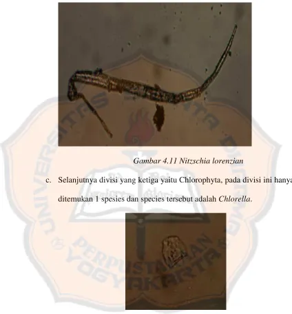 Gambar 4.11 Nitzschia lorenzian 