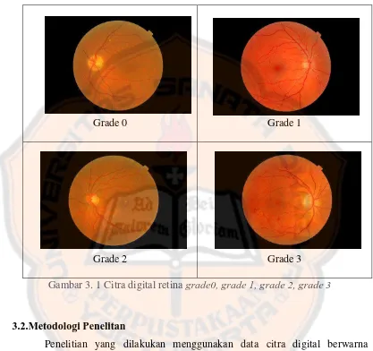 Gambar 3. 1 Citra digital retina grade0, grade 1, grade 2, grade 3 