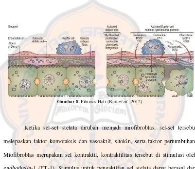 Gambar 8. Fibrosis Hati (Burt et al., 2012) 