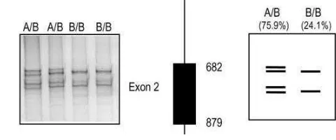 Gambar 11. Hasil Visualisasi Pita Gen GH Exon 2 pada Kambing Algarvia dengan Metode PCR-SSCP (Malviero et al., 2001) 