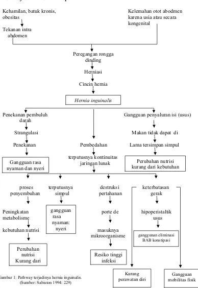 Gambar 1: Pathway terjadinya hernia inguinalis.  