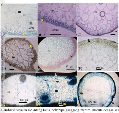 Gambar 6 Sayatan melintang talus  beberapa ganggang merah:  medula dengan sel 