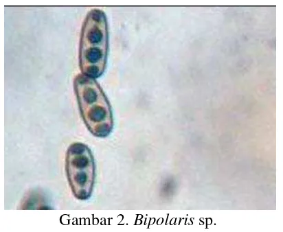 Gambar 2. Bipolaris sp. 