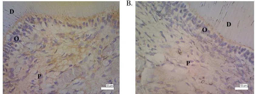 Gambar 4. Gambaran mikroskopis ruang pulpa pada kelompok akuades dengan pengecatan imunohistokimia tampak TNF-α (A) dan IL-1β (B) terekspresi dengan intensitas lemah