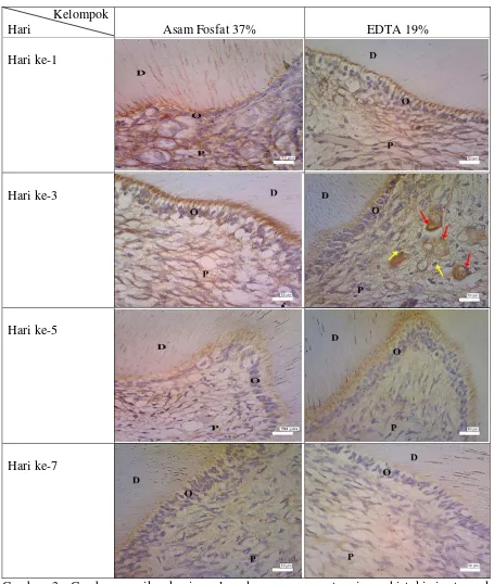 Gambar 3. Gambaran mikroskopis pulpa dengan pengecatan imunohistokimia tampak ekspresi IL-1β dengan intensitas paling kuat pada hari ke-3 setelah perlakuan