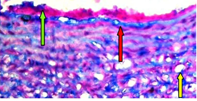 Gambar 5.2  Gambar histopatologi aorta norma pada pembesaran 400x. Tanda merah (tunika intima), tanda hijau  (tunika media) dan tanda kuning (tunika adventitia)  