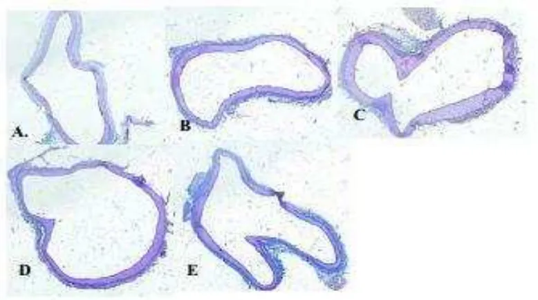Gambar 5.4.  Gambar Histopatologi Aorta dengan pewarnaan MT. (A) kontrol normal, (B) Kontrol positif, (C) Kontrol negatif dengan penebalan dinding aorta yang terlihat jelas, (D) Dosis 250mg/kgBB, (E) Dosis 500mg/kgBB 