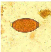 Gambar 2.1 Telur Trichuris trichiura (CDC, 2014) 