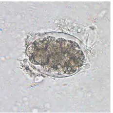 Gambar 3.1 Telur cacing tambang (hookworm) (CDC, 2014) 