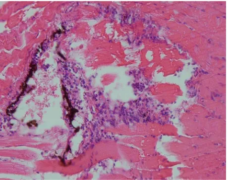 Gambar 3. Fotomikrograf kulit karper, Cyprinus carpio yang terinfeksi A. salmonicida menunjukkan peradangan, H & E