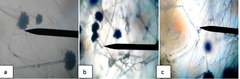 Gambar 4.3. Hifa jamur Aspergillus flavus pada perbesaran 40 x 10 (a) Hifa normal (b) Hifa membengkok (c) Hifa menggulung  