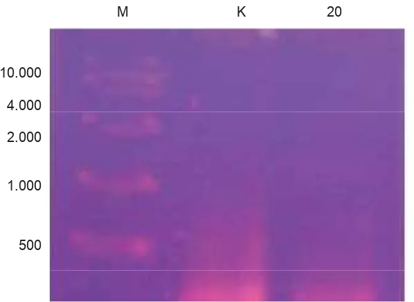Gambar 4.  Uji sensitivitas isolat bakteri anemon laut terhadap V. parahaemolyticus. BNL 2.1 menunjukkan isolat bakteri yang mempunyai aktivitas ditandai dengan adanya zona hambat disekelilingnya.