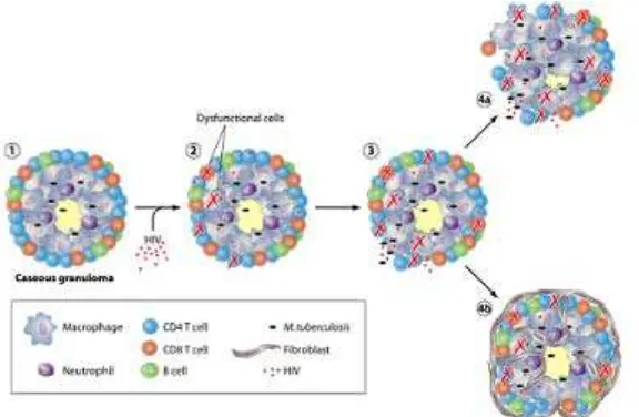Gambar 2.3 Mekanisme Aktivasi TB Laten oleh HIV 
