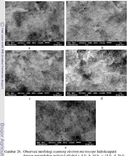 Gambar 26.  Observasi morfologi scanning electron microscope hidroksiapatit 