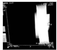 Gambar 2. Tampilan scanogram phantom