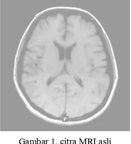 Gambar 1. citra MRI asli 