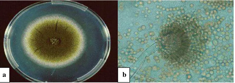 Gambar 2.2 a. Penampakan makroskopis Aspergillus flavus (Hedayati et al., 2007), b. Penampakan konidia mikroskopis Aspergillus flavus perbesaran 100x (Safika, 2008) 