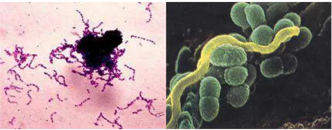Gambar 2.3 Streptococcus mutans (Hidayaningtias, 2008; Nugraha, 2008) 