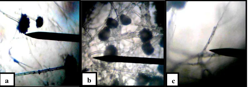 Gambar 4.3 Hifa jamur Aspergillus flavus  pada perbesaran 40x10 (a) Hifa normal (b) Hifa membengkok (c) Hifa menggulung 