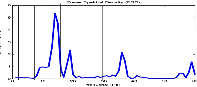 Gambar A.2 Power Spectral Density pada detik ke-10 s/d 20 (sebelum rangsangan suara)