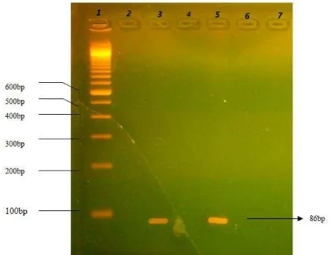 Fig 3. PCR amplification profile of  35SCaMV promoter on 