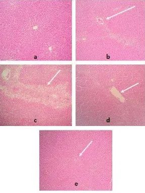 Figure 1. Histopathological specimen stained with H&E  group revealing slight decrease in centrilobular necrosis and  and moderate portal inflammatory infiltrate  and (E) Tiron2 group reveals with centrilobular necrosis and microvesicular steatosis (C): TA