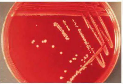 Gambar 2.2. Koloni bakteri S. aureus 