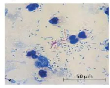 Gambar 2.1 Pewarnaan M. tuberculosis dengan Metode Ziehl-Nelsen (merah) 