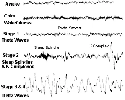 Gambar 2.4. Pola EEG pada tahap siaga dan tidur. 