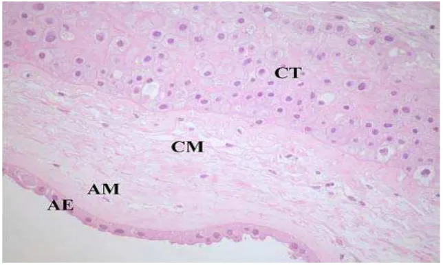 Gambar 2.2 Mikroskopik selaput ketuban pewarnaan Haematoxylin-Eosin (HE) (AE: amniotic epithelial layer, AM: amniotic mesenchymal layer, CM: chorionic mesenchymal layer, CT: chorionic trophoblastic (Parolini et al., 2008) 