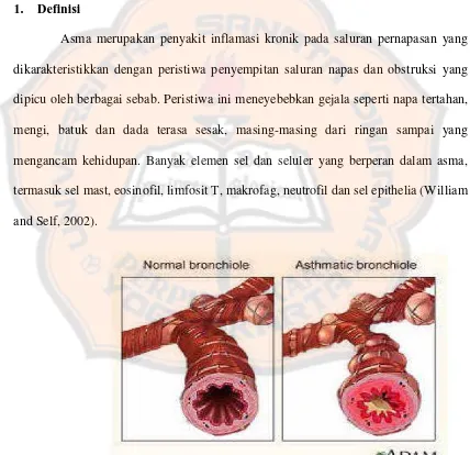 Gambar 1.  Bronkus normal dan bronkus pada penderita Asma (Adam, 