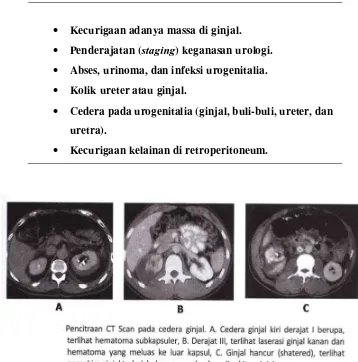 Table 2.2. Indikasi pemeriksaan CT scan pada kelainan urologi 