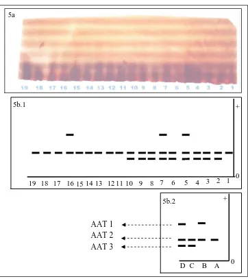 Gambar 5. Foto pita isozim AAT (5a) dan interpretasi pita isozim AAT (5b.1), serta macam pola pita isozim AAT (5b.2) pada 19 aksesi kapas