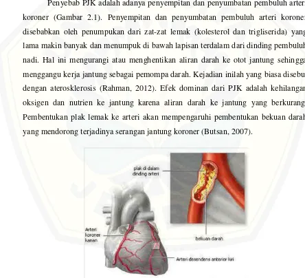 Gambar 2.1 Anatomi arteri koroner (Rahman, 2011). 