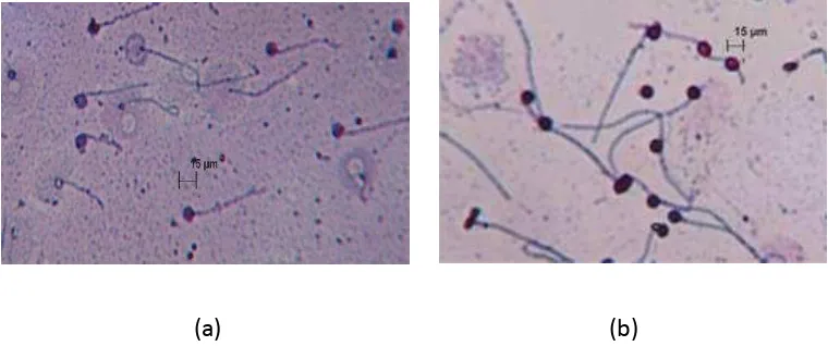 Gambar 4. Morfologi spermatozoa ikan patin (a) dan mas (b). 