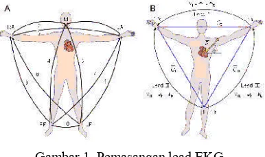 Gambar 1  Pemasangan lead EKG 