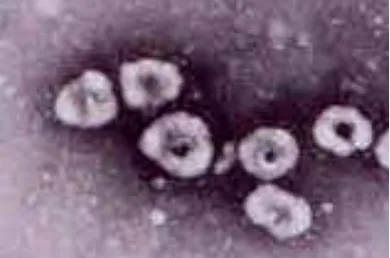 Gambar 1. Partikel coronavirus dengan gambaran mikroskop elektron (Horzinek, Lutz 2000) 