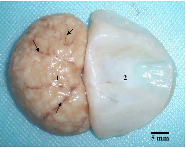 Gambar 9. Gambaran patologis  subkapsular ginjal kucing (P/11/09) yang mengalami nefritis ganuloma