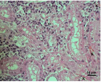 Gambar 10. Gambaran histopatologi tubular dan interstisial ginjal 