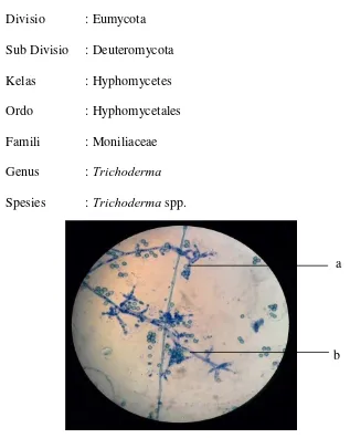 Gambar 3. Mikroskopis Trichoderma spp. (a) konidia; (b) konidiofor 