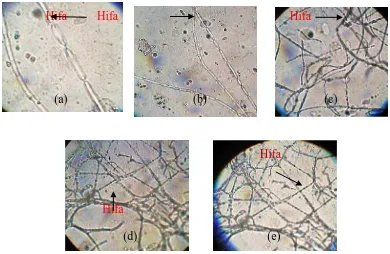 Gambar 4.Bentuk Hifa Phaeophleospora sp. (perlakuan (a) 0 mg/ml, (b) 0,4mg/ml,(c) 0,8 mg/ml, (d) 1.2 mg/ml, (e) 1,6 mg/ml)