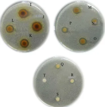 Gambar hasil uji aktivitas antibakteri terhadap  Staphylococcus aureus 