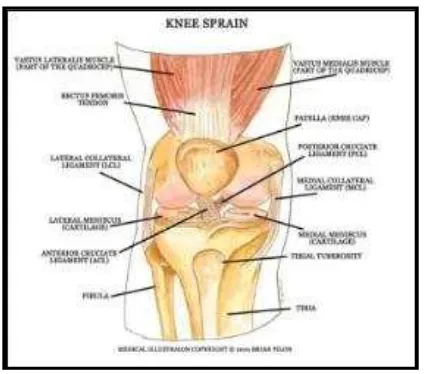 Gambar 10. Cedera knee sprain (Sumber: http://injuryguide.trainerschoice.ca pada 3 Juni 2014 jam 22.11 wib) 