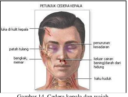 Gambar 14. Cedera kepala dan wajah 