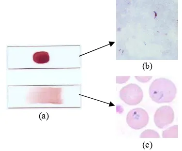Gambar 1. (a) Sediaan darah tebal (atas) dan tipis 