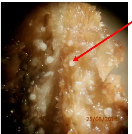 Gambar 7. Nematoda dalam jaringan akar 