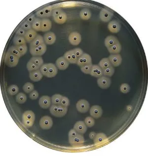 Gambar 6. Koloni Staphylococcus aureus pada media BPA (Atlas, 2010) 